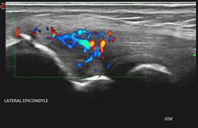 Ultrasound