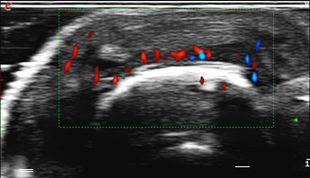 Ultrasound