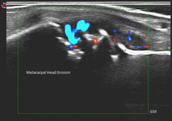 Ultrasound