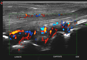 Ultrasound