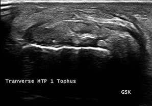 Ultrasound