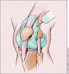 Joint injection & aspiration<