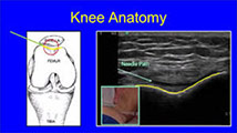 Diagnosis for Arthritis with the use of Ultrasound